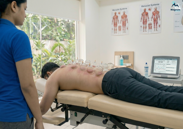 Cupping Therapy